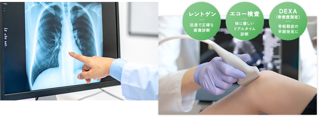 ほんだ整形外科の1：レントゲン・エコー・骨密度測定による正確な診断（和歌山市 中松江駅徒歩6分）