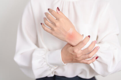 手首・指が痛い原因