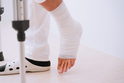 骨折？打撲？捻挫？見分け方と受診目安｜和歌山市の整形外科「ほんだ整形外科」中松江駅徒歩5分